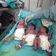 EKO TURKIYA ANTALYA KIPR IVF Tel : 913250221