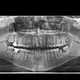 تبادل حالات سريرية طب أسنان صنعاء
