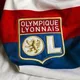 🔴المپیک لیون| Olympique Lyon🔵