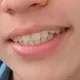 RÃI LINK 3 CHỊ EM